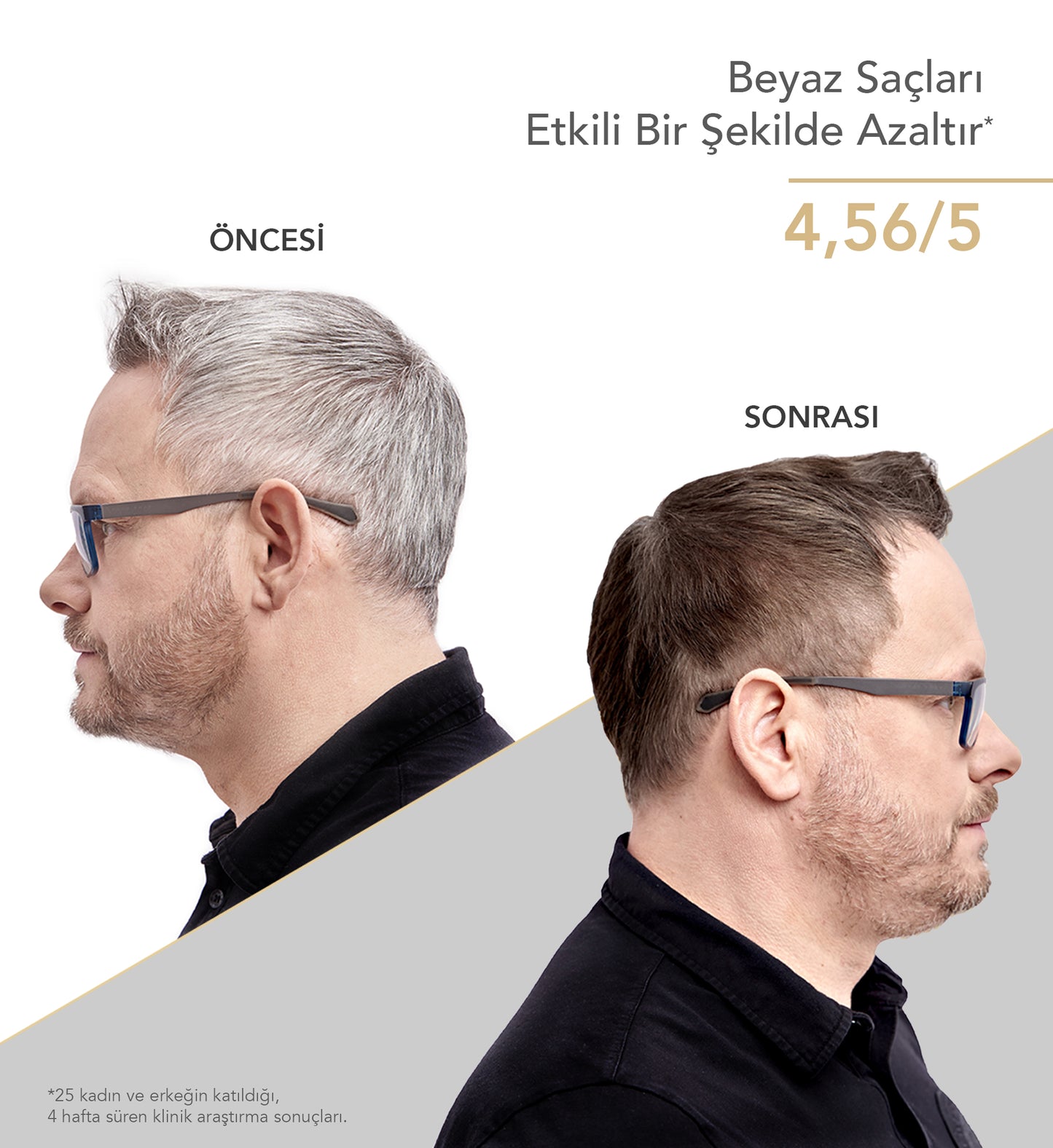 GR-7 ANTI-GREY SAÇ LOSYONU